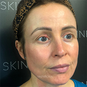 Skinboss - Case Study - Karen Knight