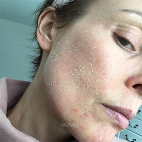 Skinboss - Case Study - Karen Knight