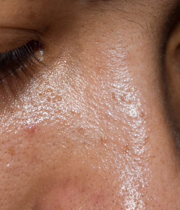 Skinboss - Oily Skin