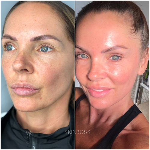 Skinboss - Ageing - Before & After