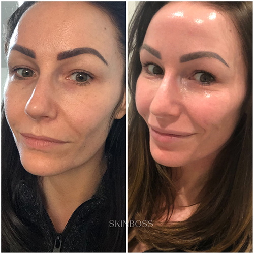 Skinboss - Ageing - Before & After