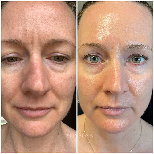 Skinboss - Ageing - Before & After