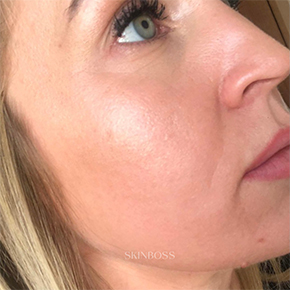 Skinboss - Case Study - Lucy Harris