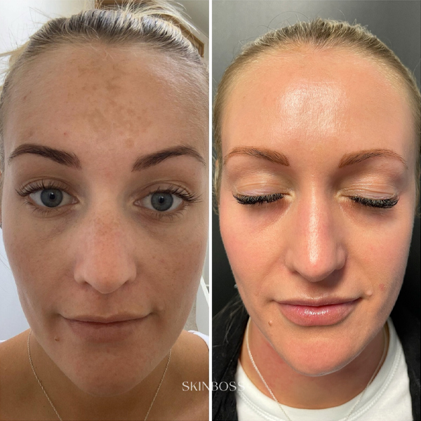 Skinboss - Case Study - Janine Osborn