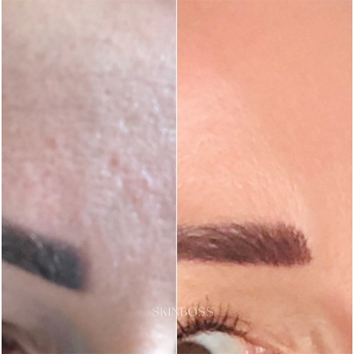 Skinboss - Pore & Texture Correction - Before & After